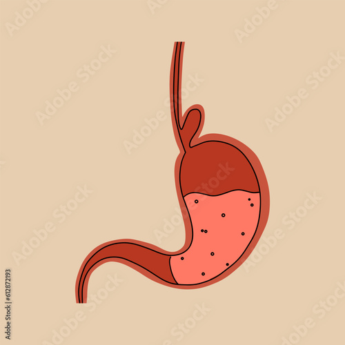 Hernia of the esophagus. Stomach problem. Vector illustration in flat style