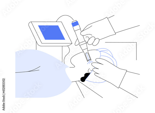 Medical laser application abstract concept vector illustration.
