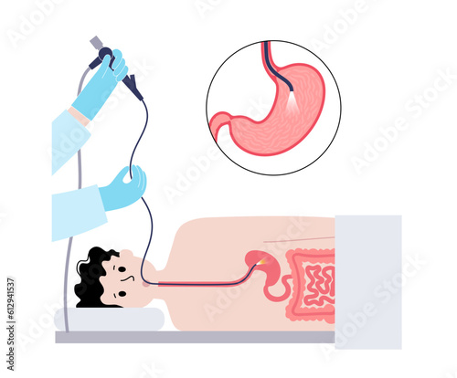 Gastroscopy endoscopy procedure