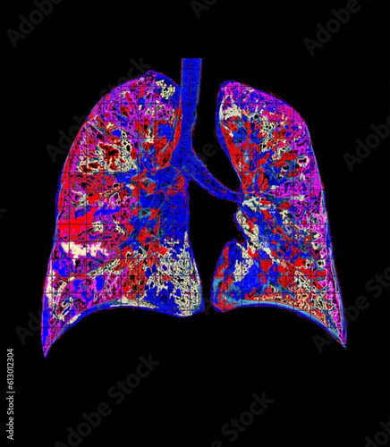 Colored chest ct scan 3d background radiology  

