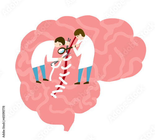 Brain surgery flat vector concept. Doctors tiny people putting stitches on human head organ. Medical healthcare illustration