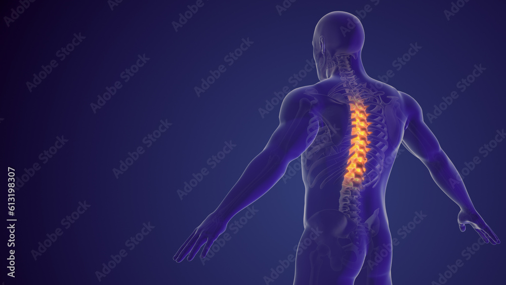 Spinal pain or back pain medical background