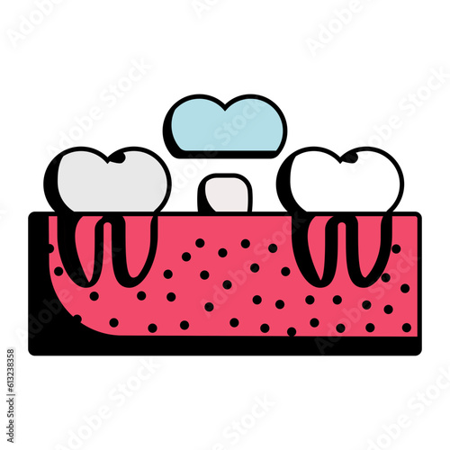 Traditional dental bridge concept,  Fixed-Moveable teeth restoration vector icon design, Dentures symbol,Oral Healthcare sign, Dental instrument stock illustration 