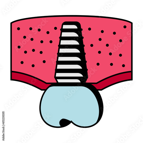 Dental Implant concept, artificial prosthetic tooth root vector icon design, Dentures symbol,Oral Healthcare sign, Dental instrument stock illustration 