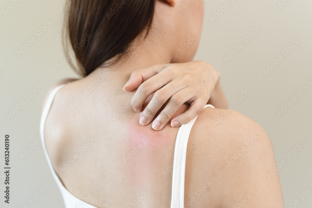 Sensitive skin allergic concept, Woman itching on her back have a red rash from allergy symptom and from scratching. Sensitive skin allergic concept, Woman itching on her back have a red rash from allergy symptom and from scratching.