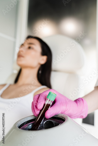 Close-up inserting test tube with blood in centrifuge to get plasma of patient girl for PRP Platelet Rich Plasma procedure. Platelet Rich Plasma PRP for improves skin volume and texture.