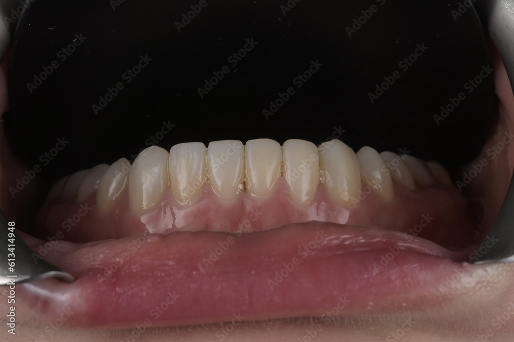 Enchanting Dental Masterpieces: Unveiling Captivating Images of Dental Perfection