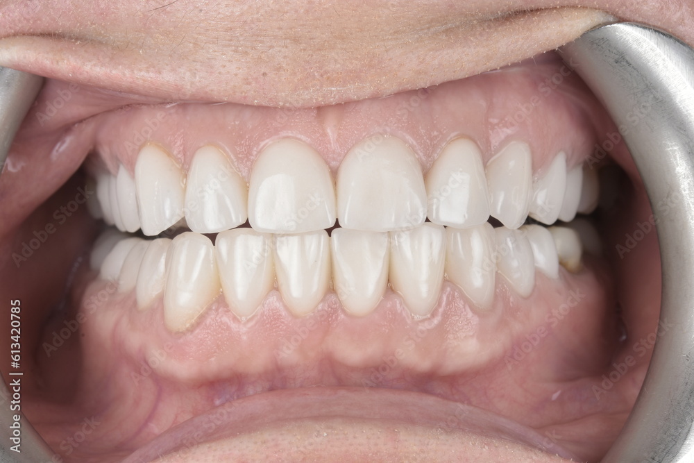 Obraz premium Enchanting Dental Masterpieces: Unveiling Captivating Images of Dental Perfection