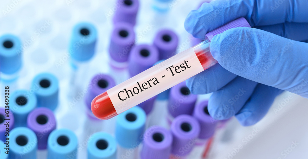 Naklejka premium Doctor holding a test blood sample tube with Cholera test on the background of medical test tubes with analyzes.