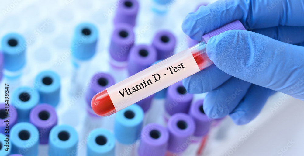 Obraz premium Doctor holding a test blood sample tube with Vitamin D test on the background of medical test tubes with analyzes