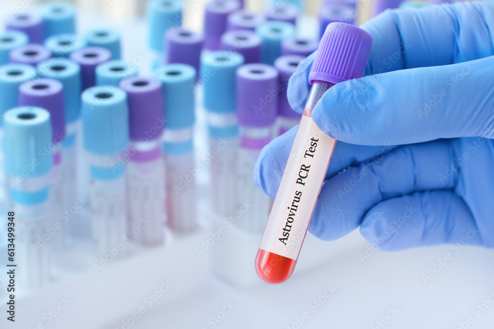 Doctor holding a test blood sample tube with Astrovirus PCR test on the background of medical test tubes with analyzes.