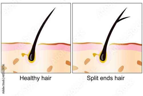 Healthy hair and split ends hair with scalp layer photo