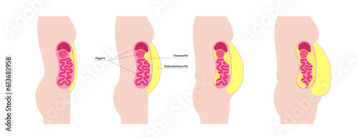 Visceral fat diagram
