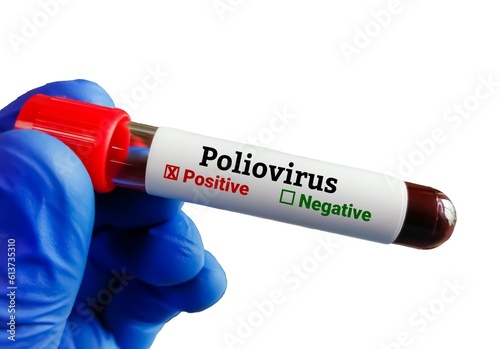 Closeup view of scientist hand hold blood sample for Polio virus test. photo