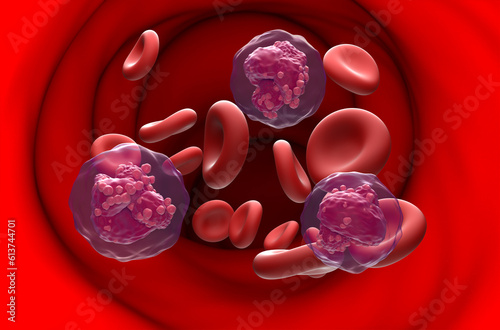 Acute lymphoblastic leukemia (ALL) cancer cell in blood flow - section view 3d illustration