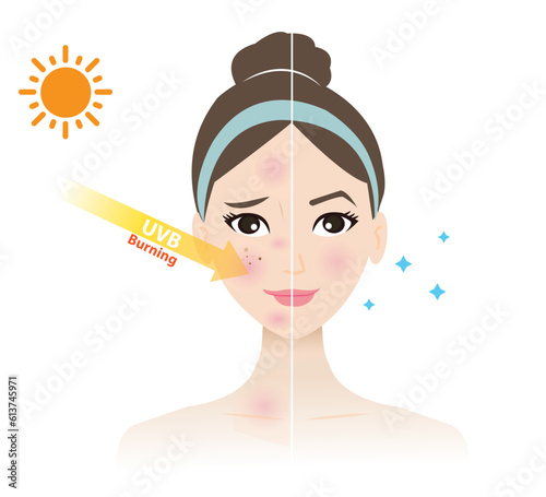 UVB rays penetrate into the woman face, resulting in burn, inflammation, aging, wrinkle, photoaging and red spots vector isolated on white background. Comparison of damaged and beauty skin.