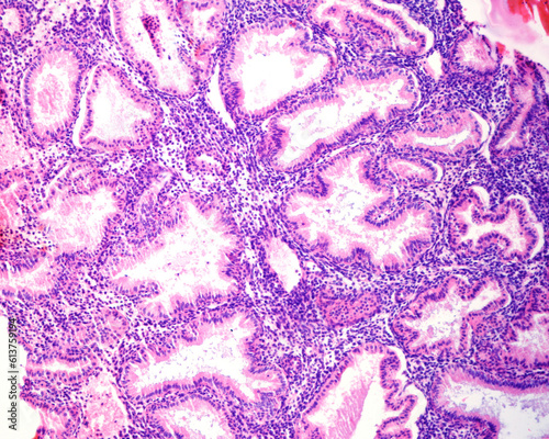 Human endometrium. Secretory phase photo