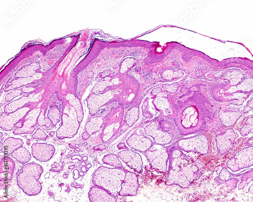Human skin. Sebaceous glands photo