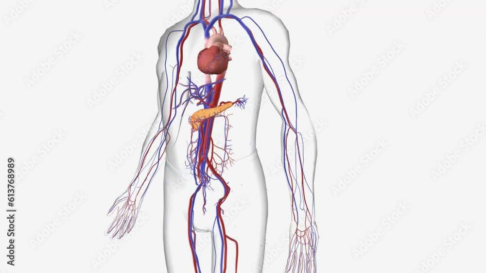 Hypercalcemia is a condition in which the calcium level in your blood is above normal Hypercalcemia is a condition in which the calcium level in your blood is above normal
