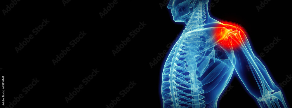 X-ray of a human body with a red mark on the shoulder. Shoulder pain concept motif banner. X-ray of a human body with a red mark on the shoulder. Shoulder pain concept motif banner.