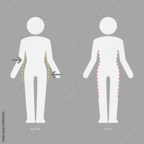 Woman body pictogram before and after losing weight .Yellow outline shows overweight from fat to slim figure with arrows. Editable weight loss icon template. Waist, belly, hip and buttocks lost.