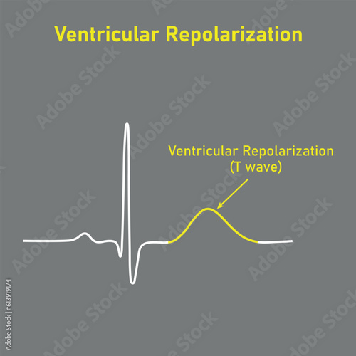Ventricular repolarization, T wave. The QT interval of ECG. The cardiac cycle. ECG of a heart in normal sinus rhythm. Resources for teachers and students.