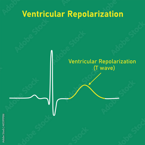 Ventricular repolarization, T wave. The QT interval of ECG. The cardiac cycle. ECG of a heart in normal sinus rhythm. Resources for teachers and students.