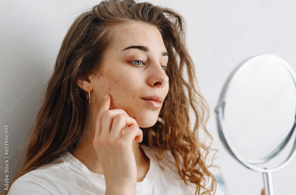 oung woman with problem skin looking into mirror. Dermatology. Allergic reaction from cosmetic, red spot or rash on face. oung woman with problem skin looking into mirror. Dermatology. Allergic reaction from cosmetic, red spot or rash on face.