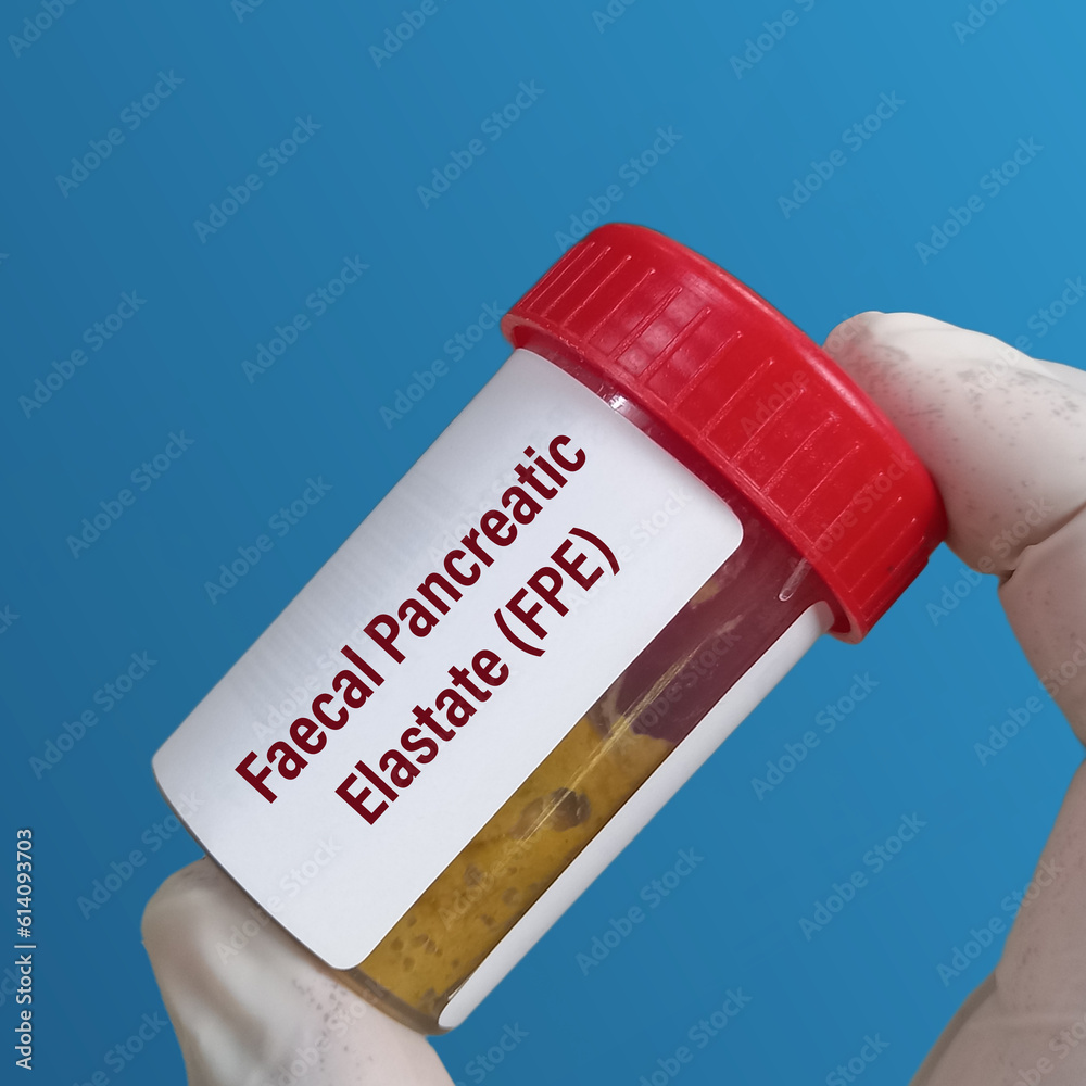 Stool sample in plastic container for Fecal Elastase (FE1) test or