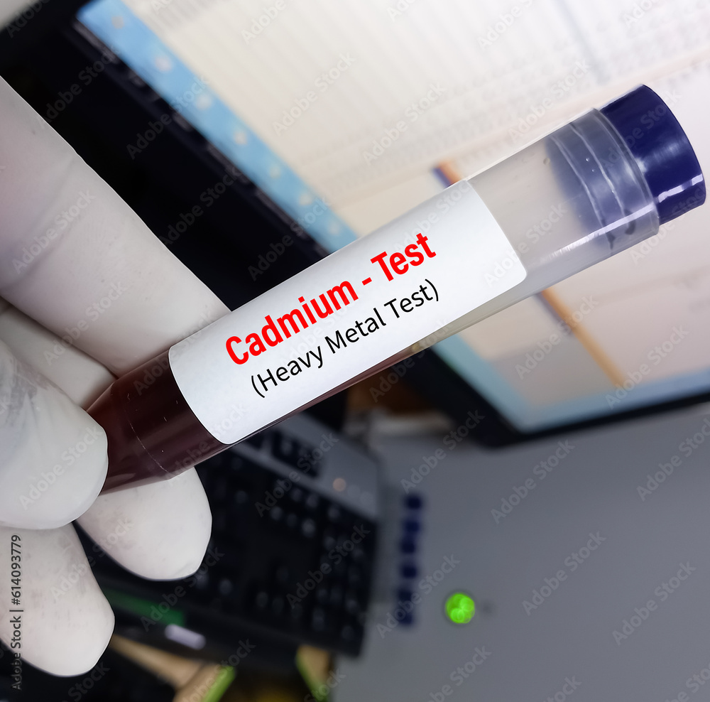Urine sample for cadmium (heavy metal) test, toxic metal.