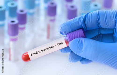 Photography Doctor holding a test blood sample tube with food intolerance test on the background of medical test tubes with analyzes
