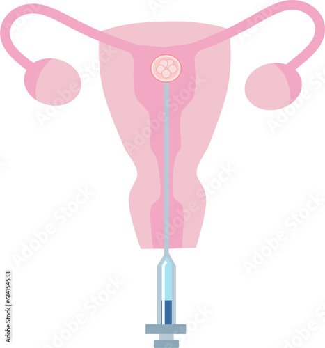 ET Embryo Transfer vector illustration. Perfect for presenting anything about reproduction, insemination or ivf.