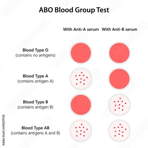 ABO Blood Group Test