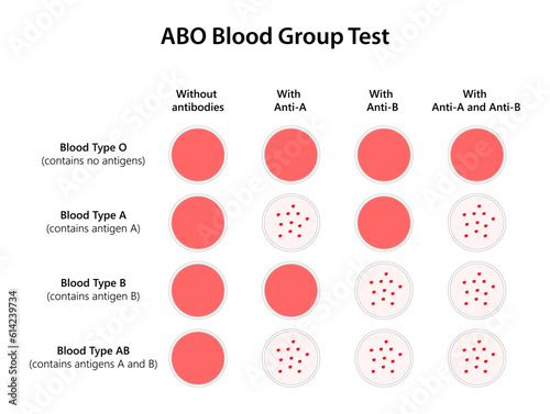 ABO Blood Group Test