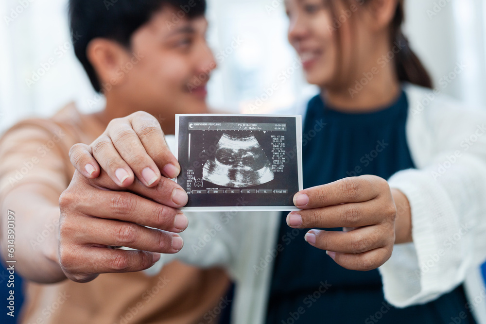 close-up view pregnant woman carefully looking at ultrasound film with his lover look happy family preparation ideas Marriage and couple concept.