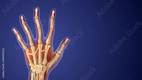 Rheumatoid arthritis of hand medical background photo