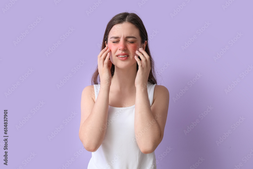 Allergic young woman with sunburned face on lilac background Allergic young woman with sunburned face on lilac background