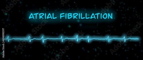 ECG example of atrial fibrillation with light effect