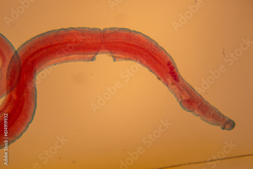 photo of human parasite worms under the microscope photo