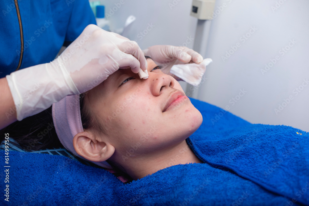 A patient has a facial prior to a cosmetic surgery procedure. Cleaning the bridge of the nose of a client with wet wipes, removing oil, makeup, and other residue. Preoperative preparation. A patient has a facial prior to a cosmetic surgery procedure. Cleaning the bridge of the nose of a client with wet wipes, removing oil, makeup, and other residue. Preoperative preparation.