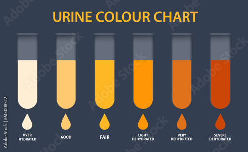 Urine colour chart. Hydration and dehydration level diagram. Medical urinal test kit for urinary tract infection research. Containers with yellow to brown pee for urinalysis. Vector illustration photo
