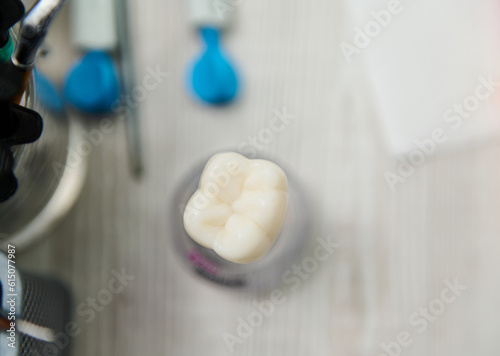 Selective focus. Top view ceramic model of enlarged human molar tooth on the worktop in dentist's office. The concept of dental prosthesis installation in modern dentistry clinic