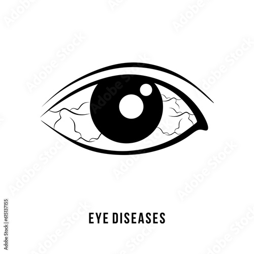 Eye diseases vector icon. Eye Infection and irritation symbol isolated on white background. Eye pain logo or sign. Vector
