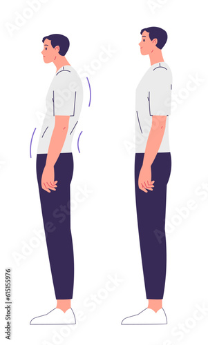 Man with impaired posture and correct posture. Spinal curvature, scoliosis