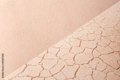 Cuadro en lienzo Before and After close-up on dry woman skin texture with dry dessert