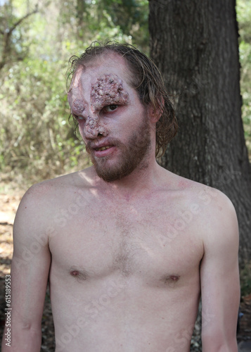 Skinny Hillbilly Redneck Mutant 	