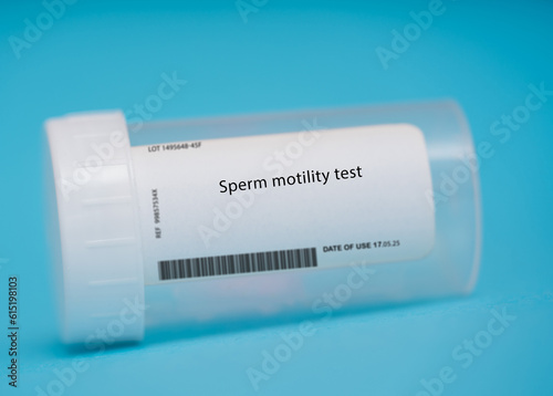 Sperm motility test