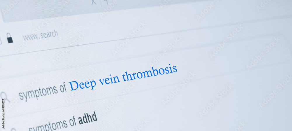 Deep vein thrombosis Deep vein thrombosis