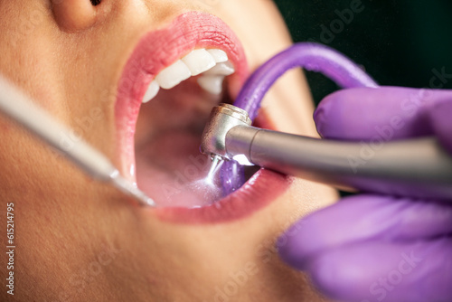 Dental treatmant with dental drill in motion photo