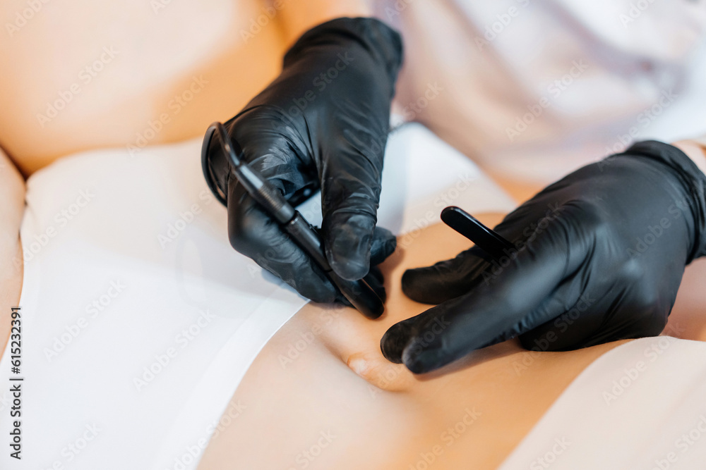 Close up view of doctor is doing electroepilation to the client, using electro needle and tweezers. Hair removal procedure, professional beauty care. Beautcian's hands in gloves. High quality photo